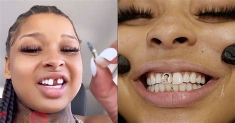 how did chrisean lose tooth|Chrisean Rock Shares New Video Of Her Smile After Getting。